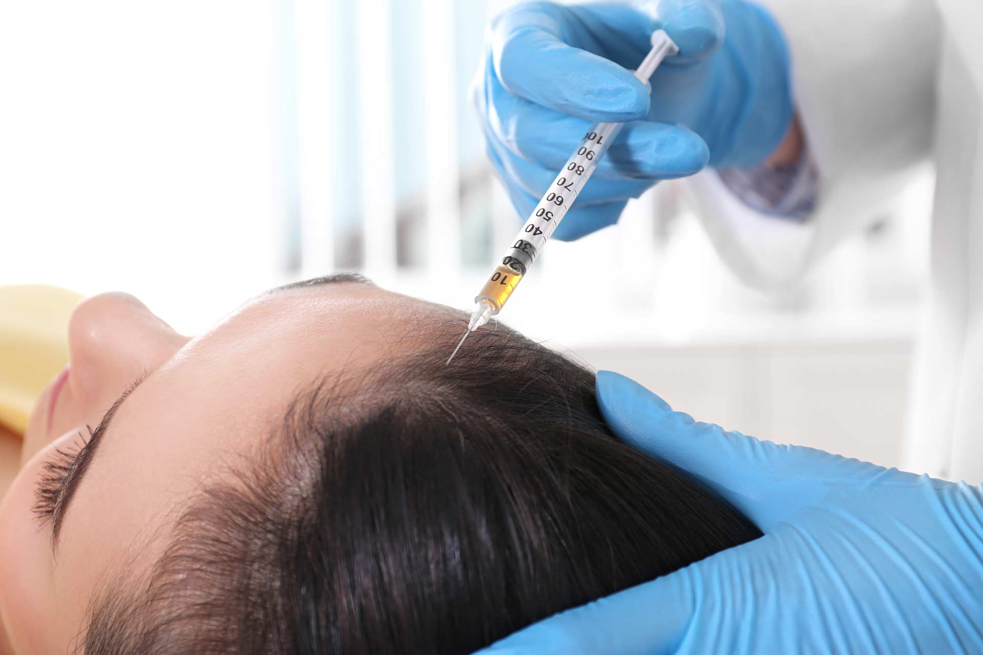 Non-Surgical Hair Loss Treatment Treatment In Ottawa