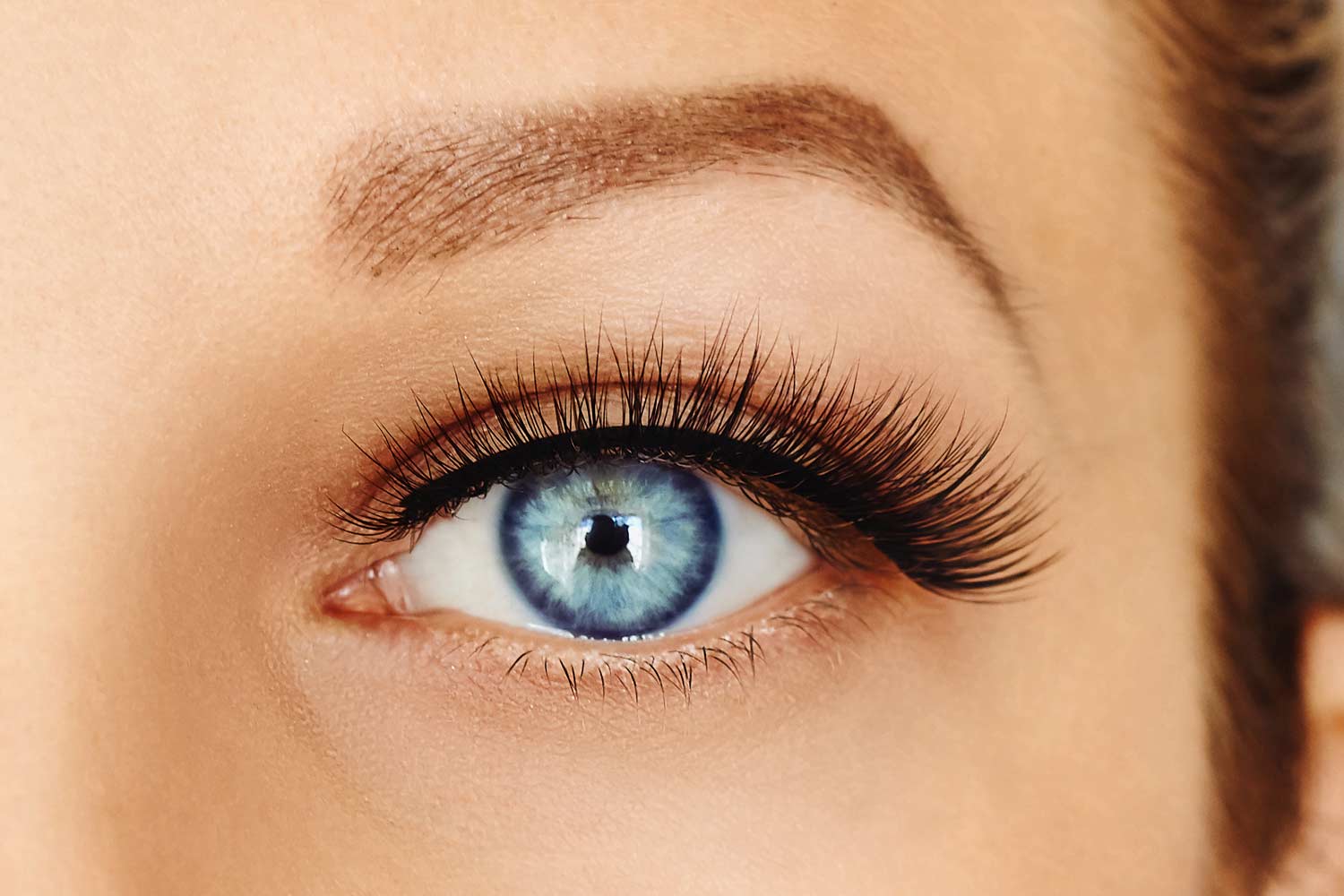 Woman with lifted, youthful brows and forehead