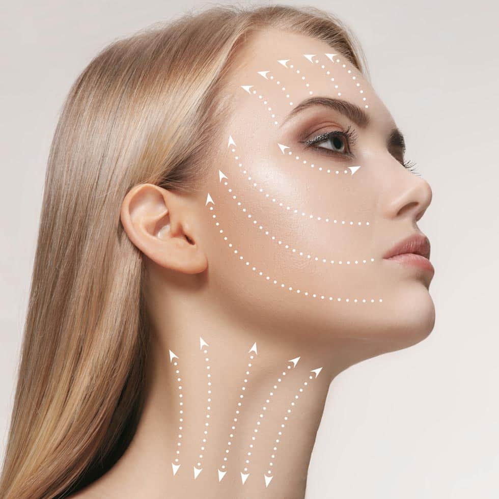 Facial Fillers