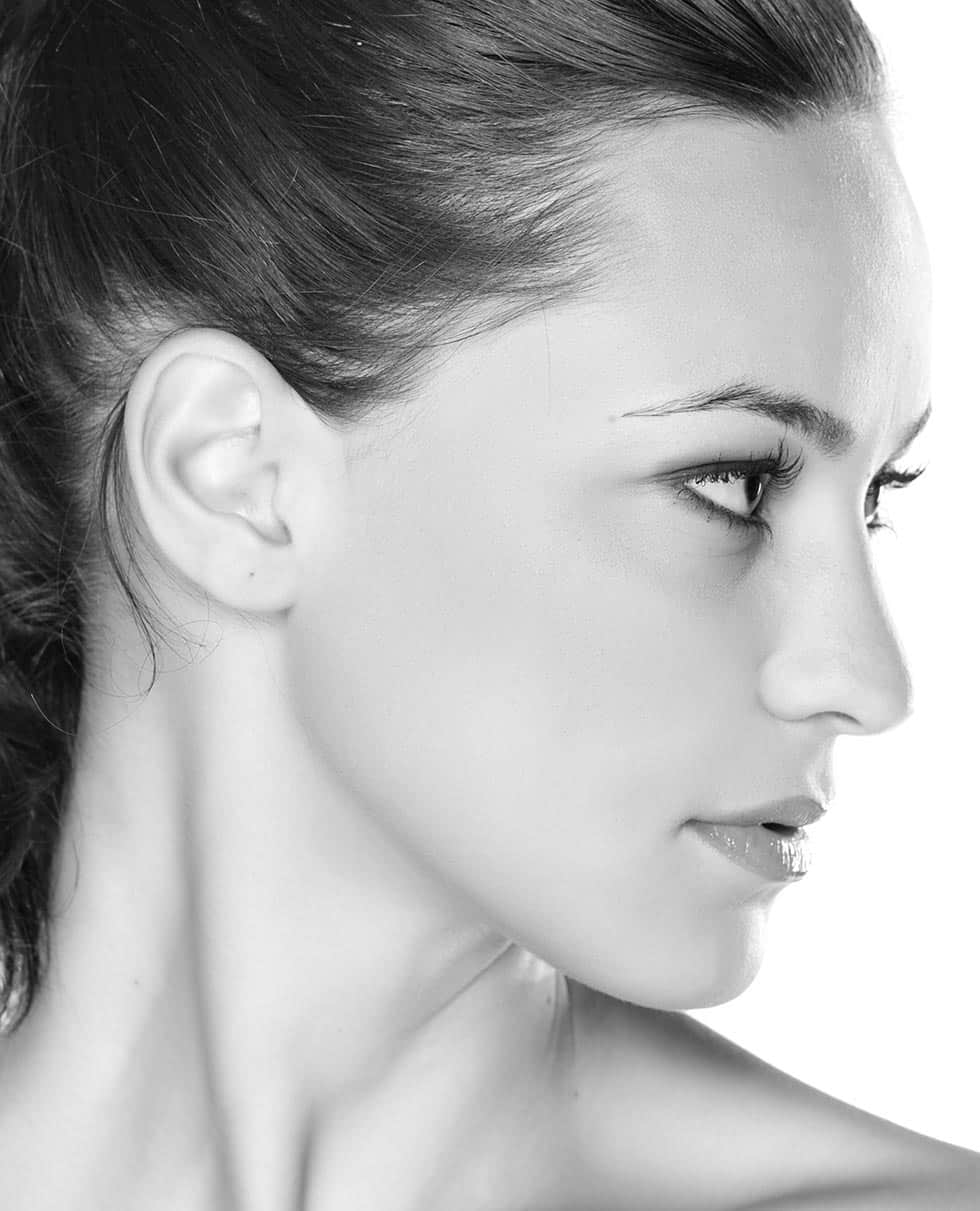 Otoplasty