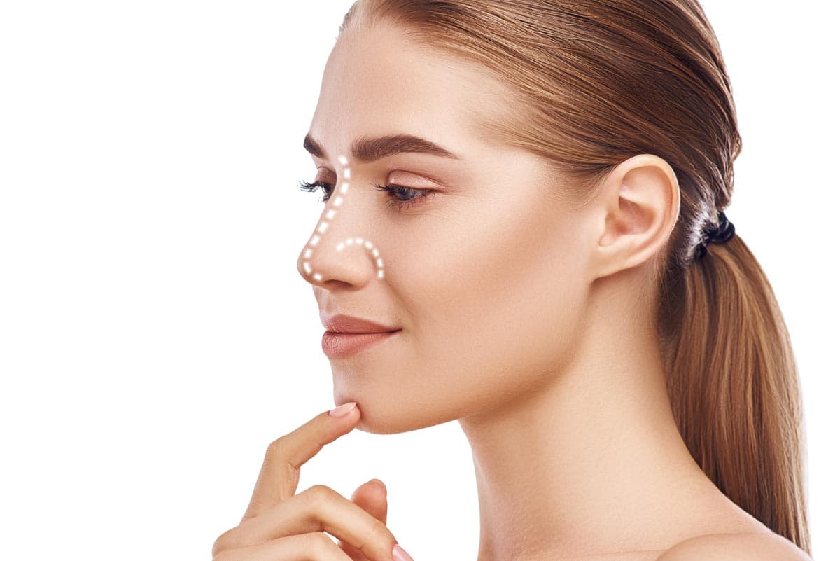 Profile of a woman after rhinoplasty surgery