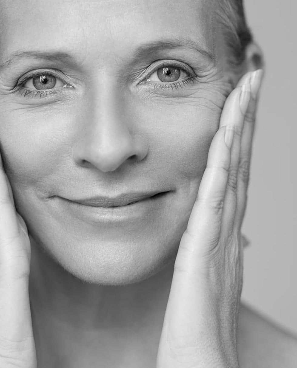 Poly-L-Lactic ACID (Sculptra®)