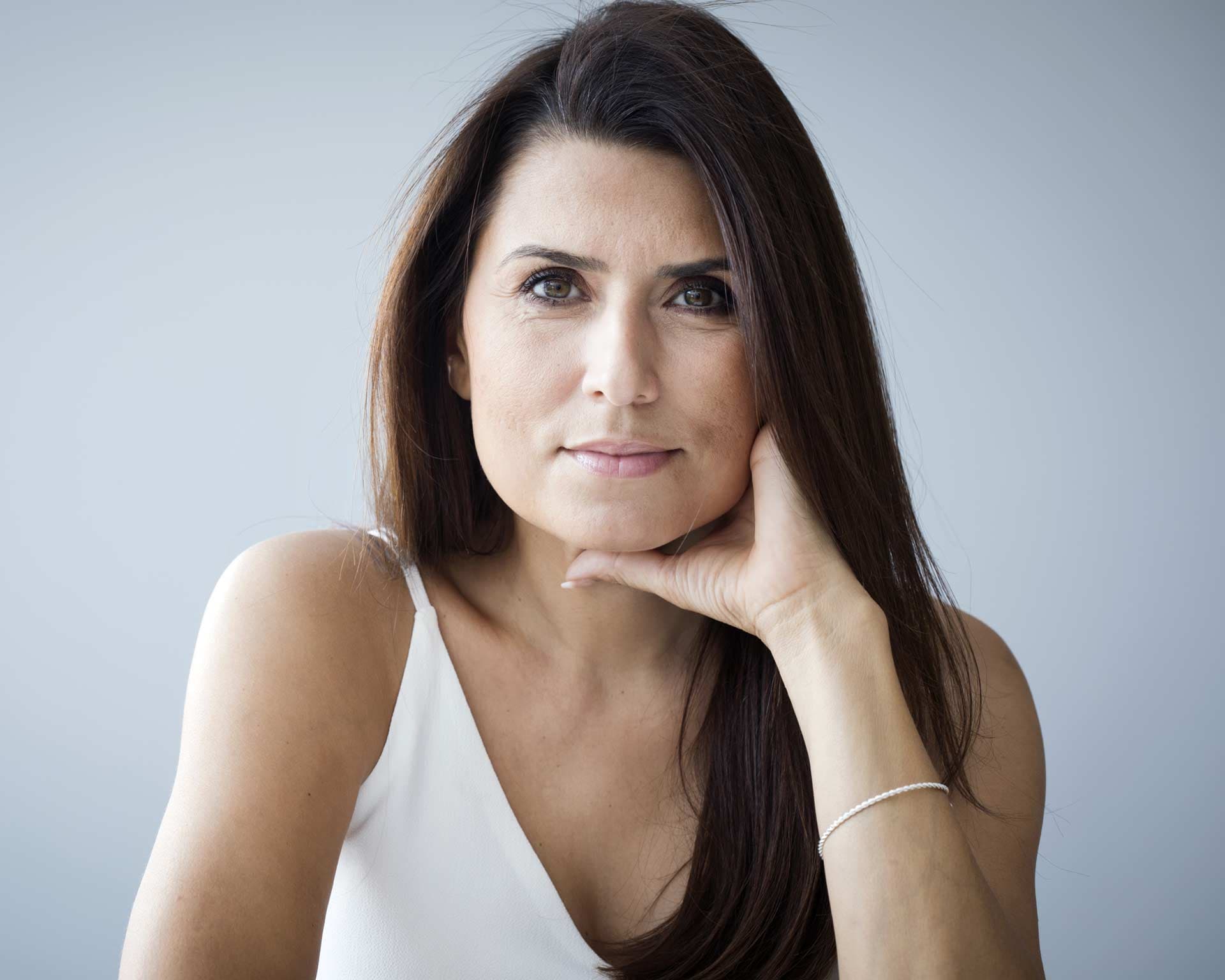 Woman with lifted, contoured facial features after a thread lift